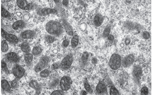 《科學(xué)轉(zhuǎn)化醫(yī)學(xué)》：2型糖尿病患者的肌肉能量產(chǎn)生是如何受損的