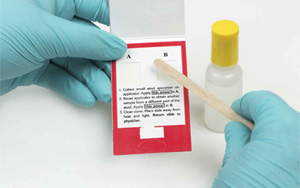 大便隱血（FOB）-免疫層析（膠體金、彩色乳膠及熒光免疫層析）解決方案