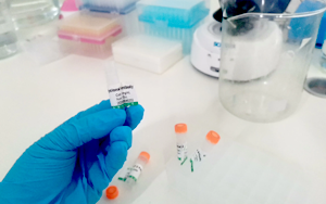 抗體稀釋緩沖液選擇及應用