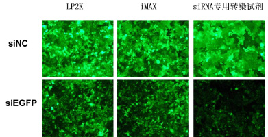 穩(wěn)定表達(dá)GFP的HeLa-EGFP細(xì)胞，沉默siEGFP，48h后熒光拍照