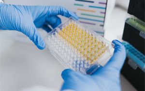 免疫技術(shù)新視界：層析、印跡、吸附與比濁的前沿碰撞