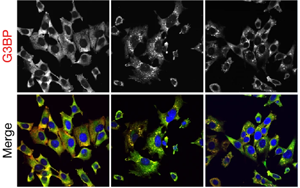 《Nature》細(xì)胞的應(yīng)激反應(yīng)比科學(xué)家認(rèn)為的更細(xì)微、更分散