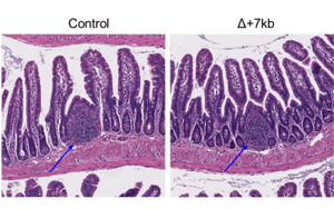 Nature：科學家新發(fā)現(xiàn)一種免疫細胞類型，與過敏有關