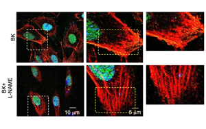 S-亞硝基化修飾 EZH2：調(diào)控內(nèi)皮穩(wěn)態(tài)的新機制與潛在治療靶點
