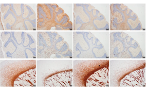 揭秘溶酶體關(guān)鍵酶 PLA2G15：靶向治療溶酶體疾病的新希望