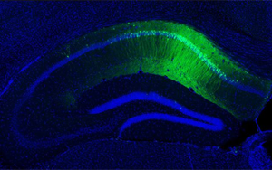 5-羥色胺(5-HT)通過調(diào)節(jié)腸道菌群-免疫軸改善加速度暴露誘導(dǎo)的大鼠腸腦軸功能障礙及認知損傷
