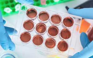 體外診斷試劑用重組人源血清基質(zhì)系列產(chǎn)品