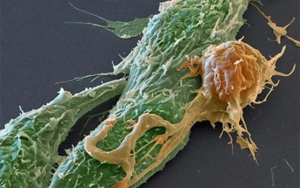 CAR-T療法和關(guān)鍵原料