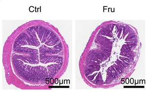 高果糖飲食通過代謝重編程促進(jìn)效應(yīng)T細(xì)胞生成加劇炎癥反應(yīng)的作用機(jī)制及二甲雙胍干預(yù)研究