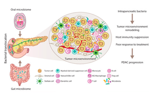 JAMA Oncology：口腔微生物群與胰腺癌風險相關