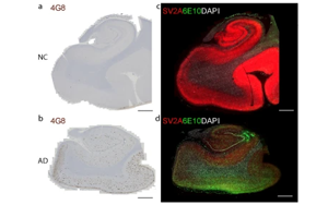 阿爾茨海默病中突觸囊泡蛋白2A在腦組織及胞外囊泡中的減少及其與Aβ、tau和APOEε4的關聯(lián)研究