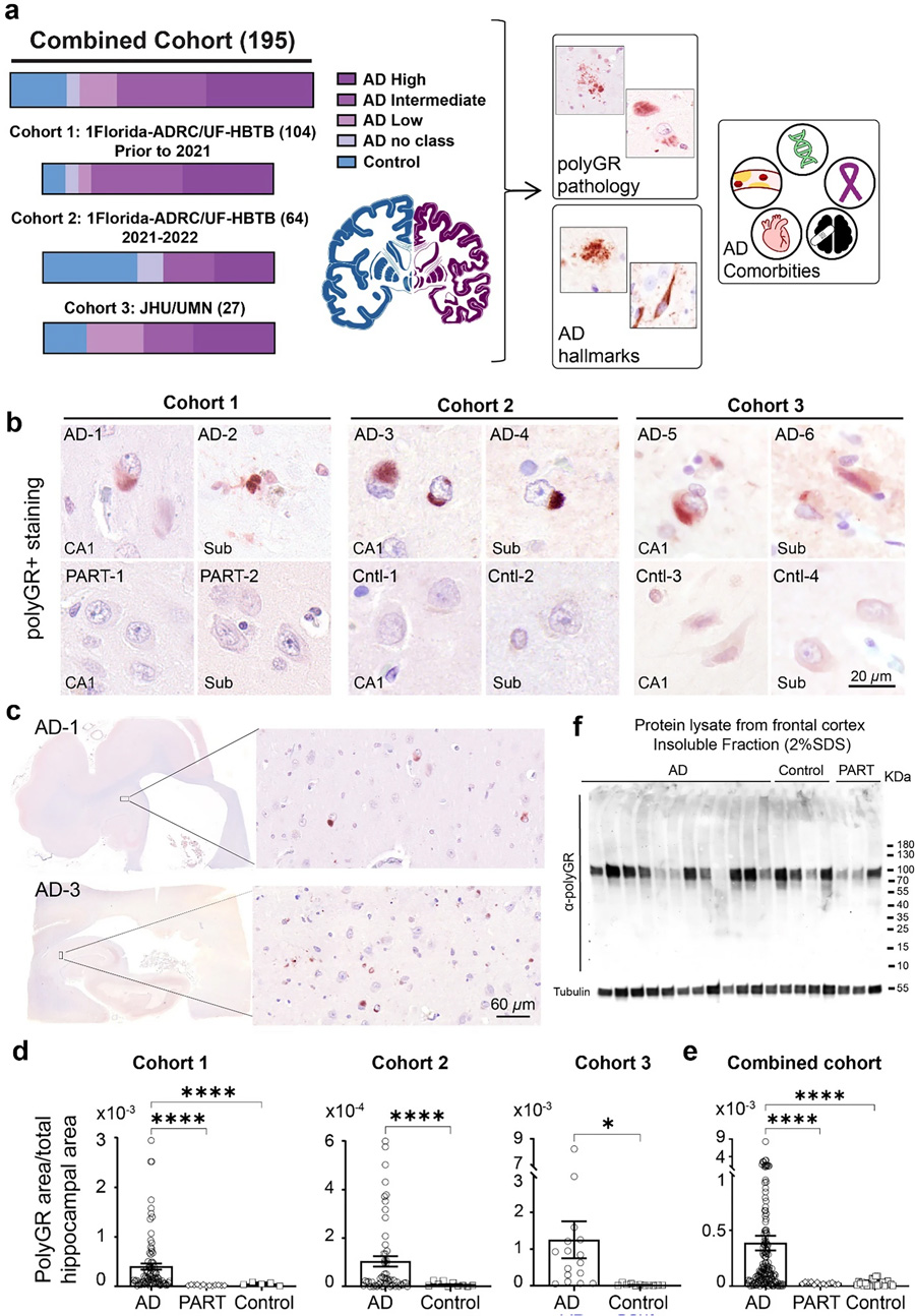 在多組阿爾茨海默病尸檢腦樣本中，海馬體頻繁檢測(cè)到PolyGR+?蛋白聚集物