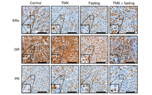 禁食通過(guò)激活糖皮質(zhì)激素來(lái)提高乳腺癌治療的療效
