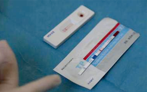 快速診斷試紙條中常用表面活性劑