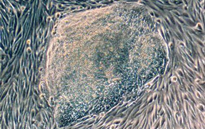 首次發(fā)現(xiàn)人類尿液來源的干細胞具有強大的再生潛力！