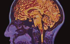 新冠帶來又一挑戰(zhàn)！下一步可能是“癡呆癥浪潮”