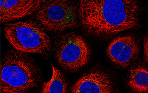 《PNAS》認識溶酶體的知識又增加了