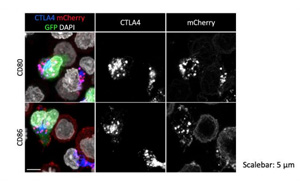 一種開創(chuàng)性的基因編輯技術(shù)可以修復(fù)免疫系統(tǒng)關(guān)鍵細胞缺陷