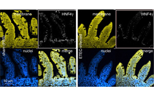 某些形式的兒童營(yíng)養(yǎng)不良和發(fā)育遲緩可以通過(guò)疫苗預(yù)防