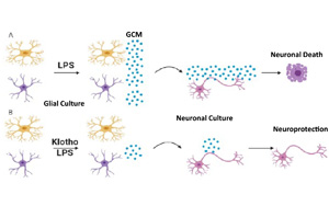 26年前發(fā)現(xiàn)的抗衰老蛋白可以對抗炎癥，避免神經(jīng)元死亡