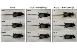 CAR-T細(xì)胞療法再獲突破！有效清除術(shù)后殘留癌細(xì)胞、預(yù)防腫瘤復(fù)發(fā)，即將開(kāi)展臨床試驗(yàn)