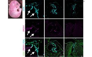 《Nature》淋巴系統(tǒng)潛在的新功能——造血！