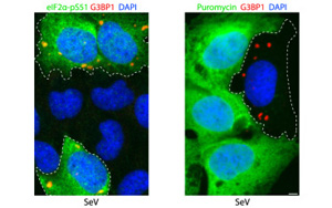 肺細胞如何保護自己免受RNA病毒感染？