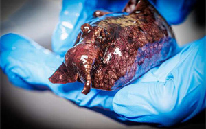 神經(jīng)信號(hào)調(diào)節(jié)新發(fā)現(xiàn)：L-或D-氨基酸？鏡像分子可改變神經(jīng)元的信號(hào)！