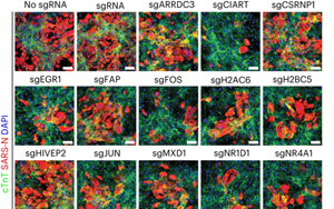確定了導(dǎo)致SARS-CoV-2感染的人類基因——CIART