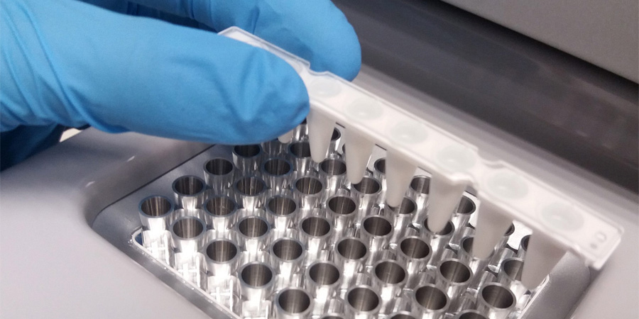 銅藍(lán)蛋白檢測