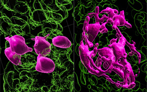 黑發(fā)原來是這樣變白的！Nature最新研究發(fā)現(xiàn)逆轉(zhuǎn)白發(fā)的關(guān)鍵所在