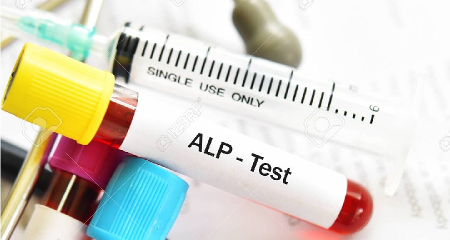 堿性磷酸酶檢測