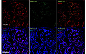 一種罕見基因突變，感覺不到疼痛！新研究揭示其獨特的分子機(jī)制