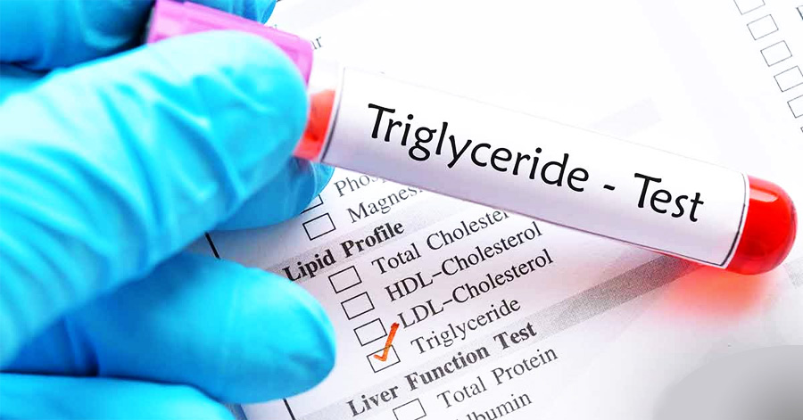 甘油三酯(TG)檢測