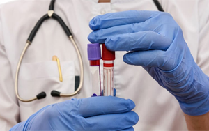 肌酸激酶同工酶（CK-MB）-磁微?；瘜W法學發(fā)光（AE/AP） /熒光免疫層析解決方案