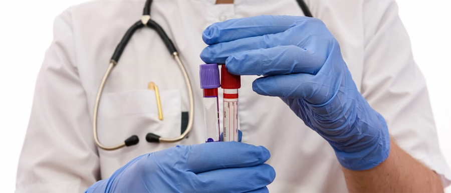 肌酸激酶MB檢測(cè)