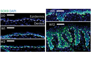 Nature子刊新研究為癌癥如何破壞干細(xì)胞精心調(diào)整的表觀過(guò)程提供了新見(jiàn)解