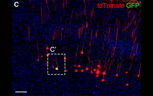 《Neuron》科學家發(fā)現(xiàn)腦力更新的生物標志物