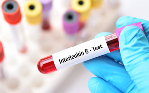 白介素-6（IL-6）-磁微?；瘜W(xué)發(fā)光（吖啶酯） /熒光免疫層析解決方案