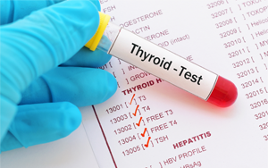 促甲狀腺素（TSH）-磁微?；瘜W發(fā)光法（吖啶酯） /熒光免疫層析解決方案