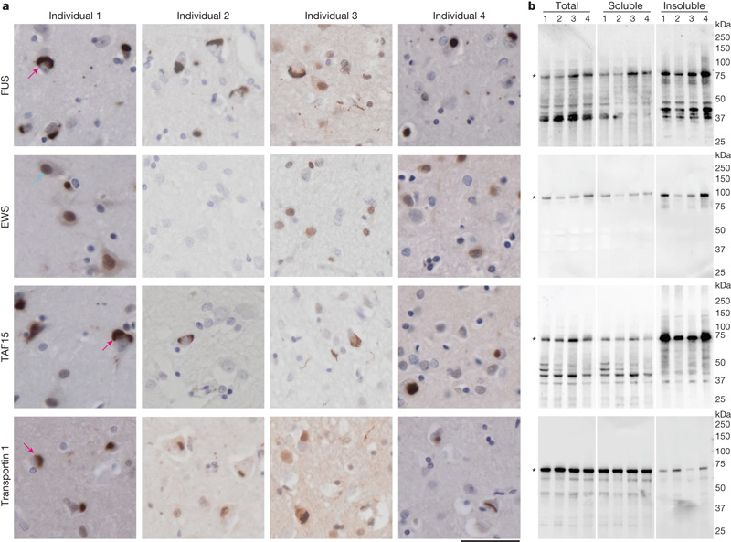 額顳葉退化蛋白包含FET蛋白和遠轉蛋白1