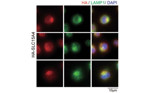 Nature子刊：開創(chuàng)性的將化學(xué)探針引入活細(xì)胞，靶向紅斑狼瘡