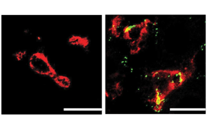 Nature子刊：肝臟中的免疫細胞會對高膽固醇水平做出反應，并吃掉多余的膽固醇