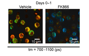 Science Immunology發(fā)現(xiàn)負責快速免疫反應的關鍵代謝過程