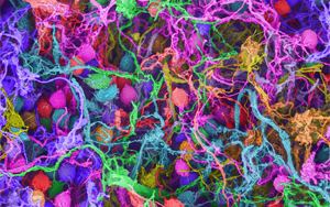 Nature：要想形成長期記憶，必須有DNA損傷和腦部炎癥？！