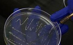 《Nature》科學(xué)家揭開了一種致命霍亂病菌背后的神秘面紗