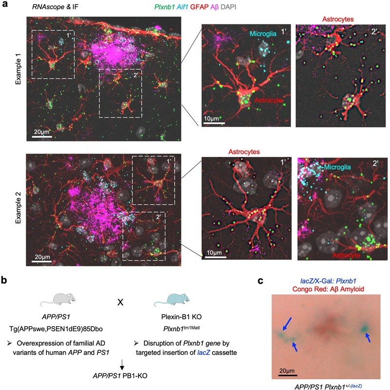 Plexin-B1在APP/PS1小鼠AD模型的斑塊周圍星形膠質(zhì)細(xì)胞中上調(diào) Plexin-B1在APP/PS1小鼠AD模型的斑塊周圍星形膠質(zhì)細(xì)胞中上調(diào)