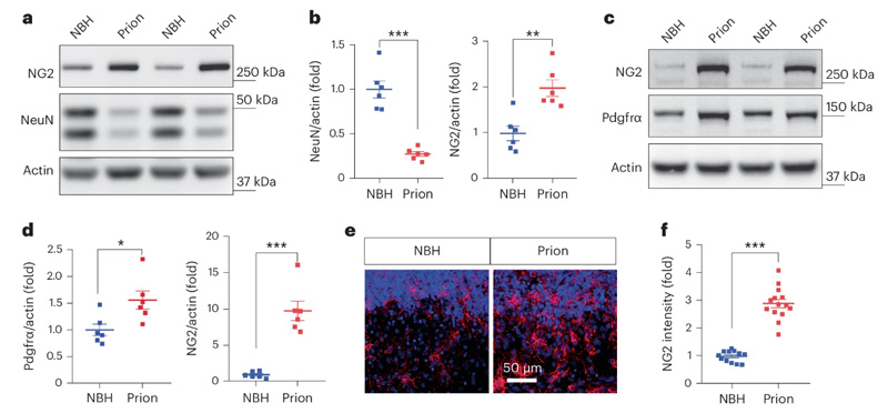 朊病毒疾病模型中NG2膠質(zhì)細(xì)胞的激活