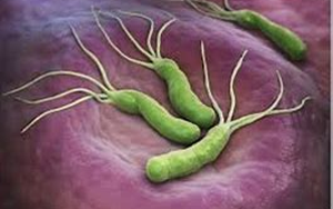 幽門螺桿菌(HP.CagA)-磁微?；瘜W(xué)發(fā)光法（AE/AP）解決方案